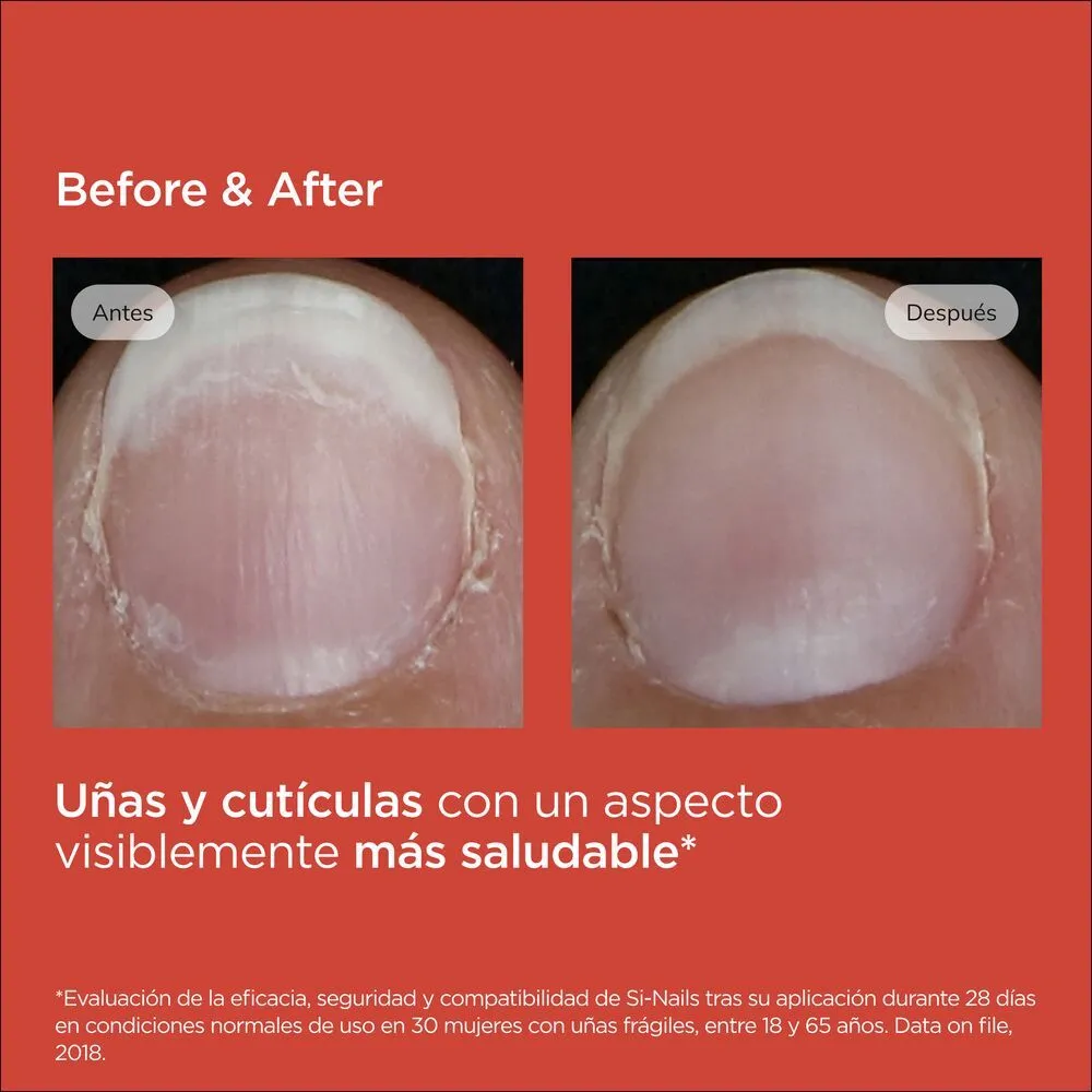 Isdin Si-Nails Fortalecedor De Uñas Click Pen - Imagen 5